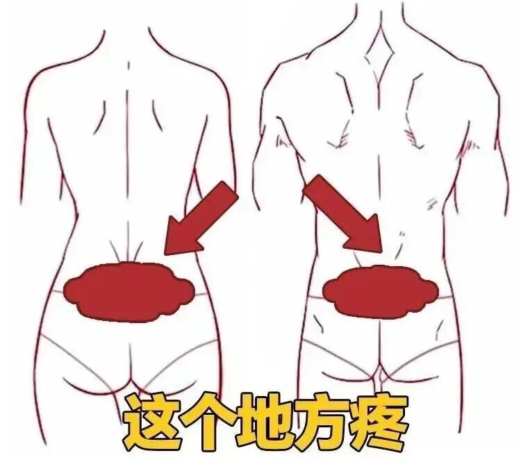 骶髂关节痛.jpg 骶髂关节痛.jpg