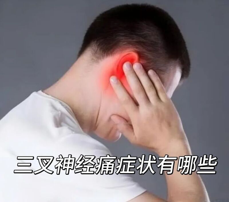 三叉神经痛.jpg 三叉神经痛.jpg
